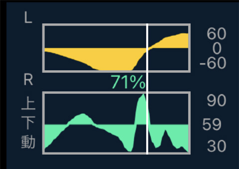 Change in foot pressure over time